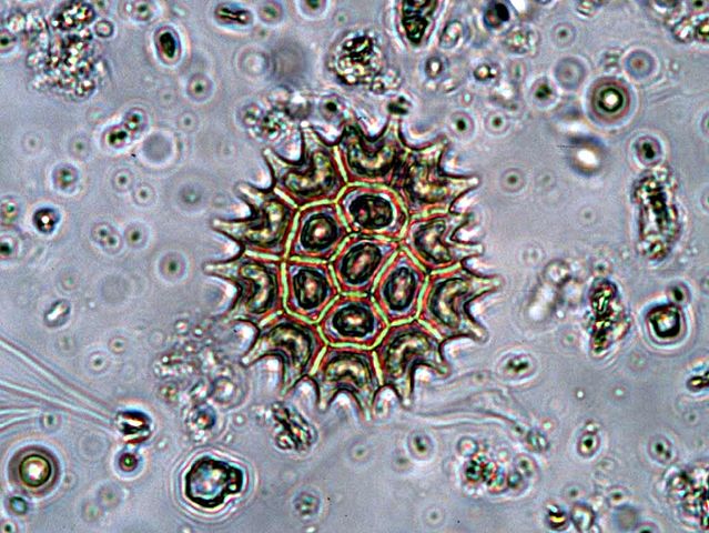 File:Pediastrumboryanum.jpg
