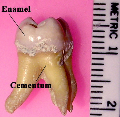 File:Labeledmolar.jpg