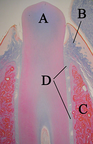 File:Eruptingtoothwithlabels11-24-05.jpg