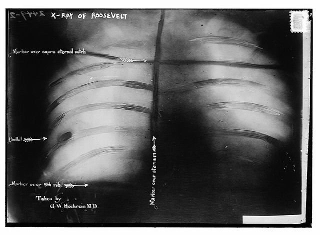 File:TR-Xray.jpg