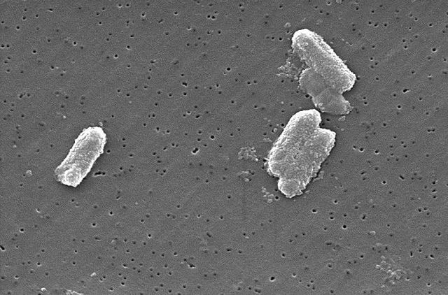 File:Citrobacter freundii.jpg