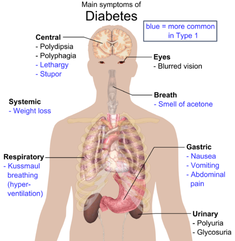 File:Main symptoms of diabetes.png
