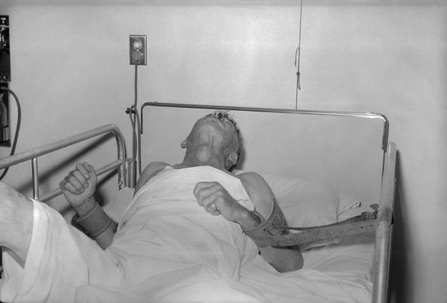 File:Rabies patient.jpg