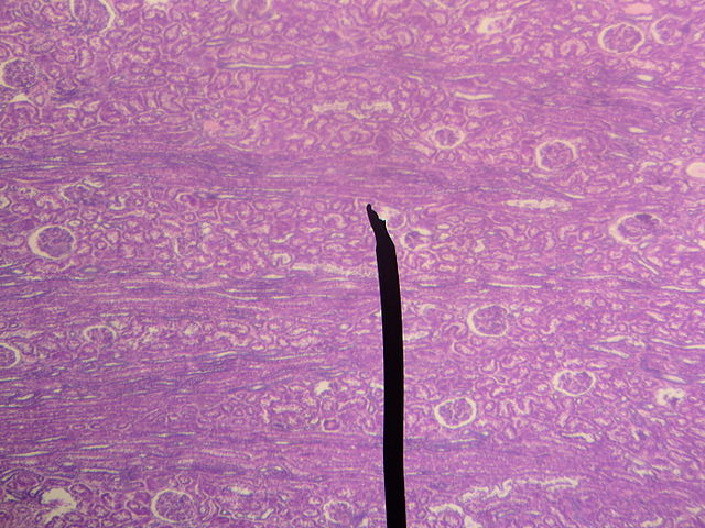 File:Kidney-Cortex.JPG