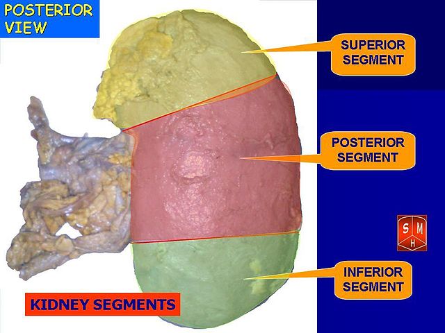 File:Slide22222.JPG