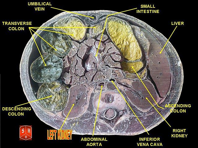 File:Left kidney.jpg