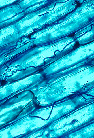 File:Neotyphodium coenophialum.jpg