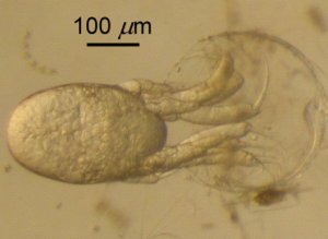 File:Nauplius Hatching.jpg