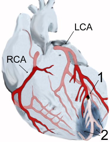 File:AMI scheme.png