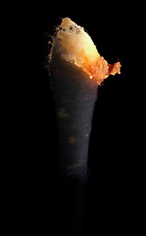 File:Earwax on swab (uv).jpg