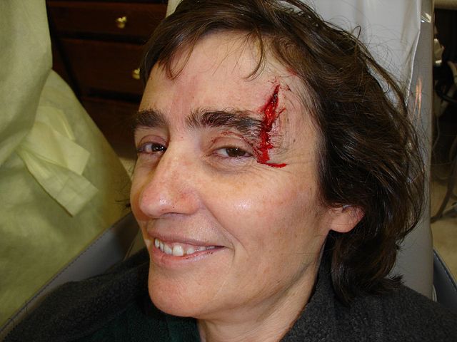 File:Bleeding.jpg