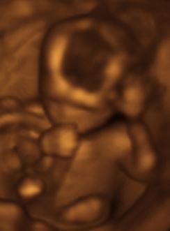 File:Sucking his thumb and waving.jpg