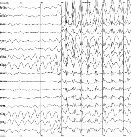 File:Spike-waves.png